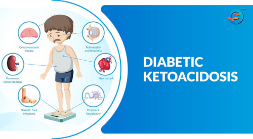 Diabetic_Ketoacidosis.jpg