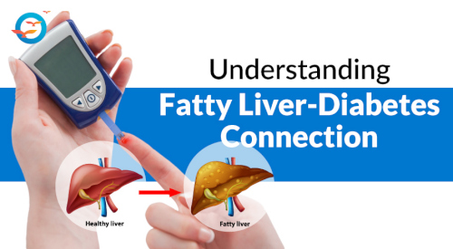 Fatty-Liver.jpg