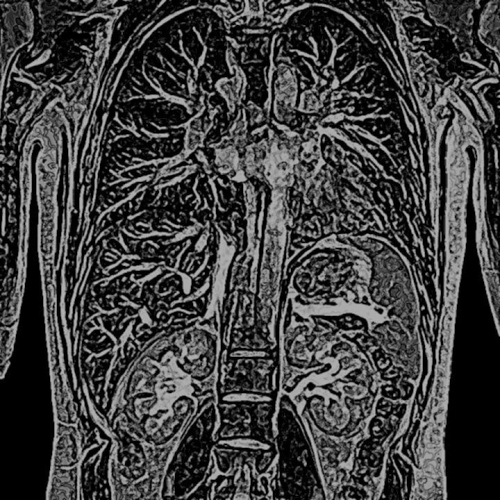 MRI_DoveImaging_000_L_01.jpg