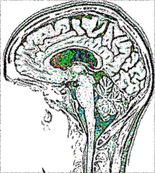 MRI_BRACES_W_02N_001_01.jpg