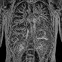 MRI_DoveImaging_000_L_01.jpg